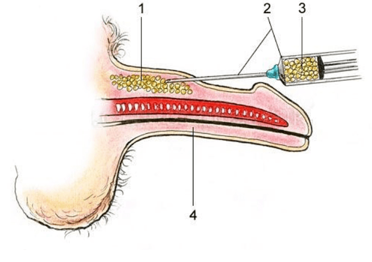Lipophilation to increase a member