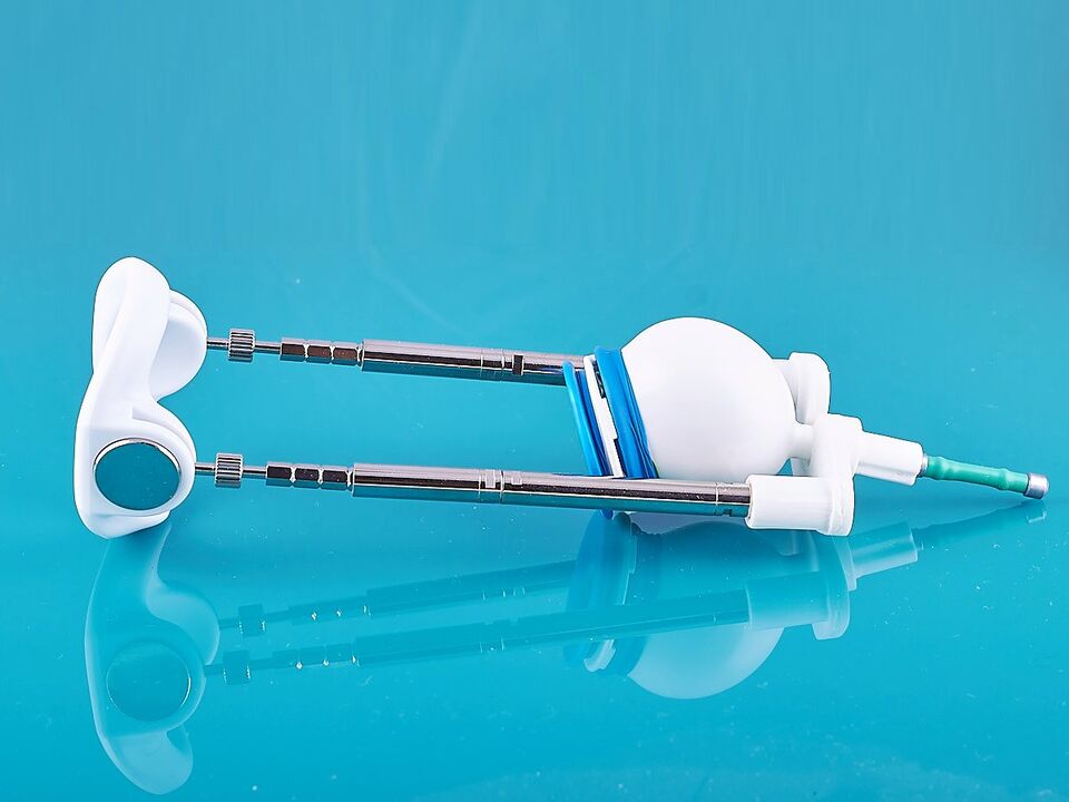 The extender will help improve the outcome of the ligamentotomy