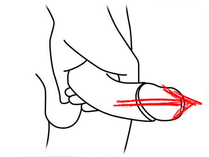 Stretch of penis for expansion